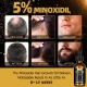 ACEITE DE SUERO SÉFRALLS  MINOXIDIL 6X60ML  World Shop ACEITE DE SUERO SÉFRALLS  MINOXIDIL 6X60ML  World Shop